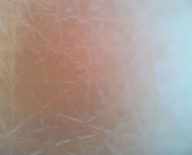 乾燥肌 肌トラブル