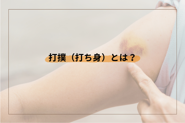 打撲や打ち身とは