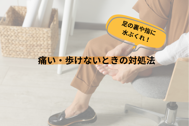 歩きすぎて足の裏や指に水ぶくれ！痛い・歩けないときの対処法」