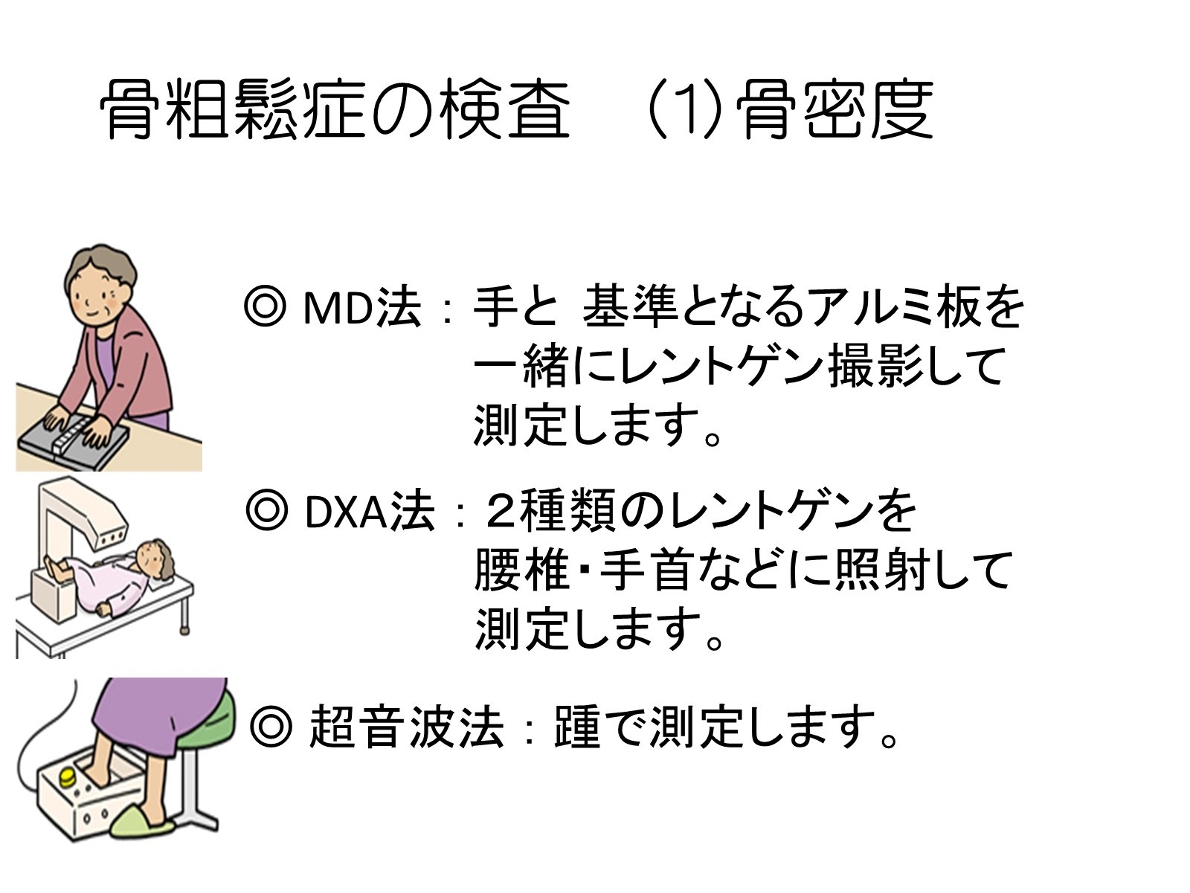 骨粗しょう症の検査 お知らせ 医療法人社団 かとう整形外科 病院 介護ナビ Milmil