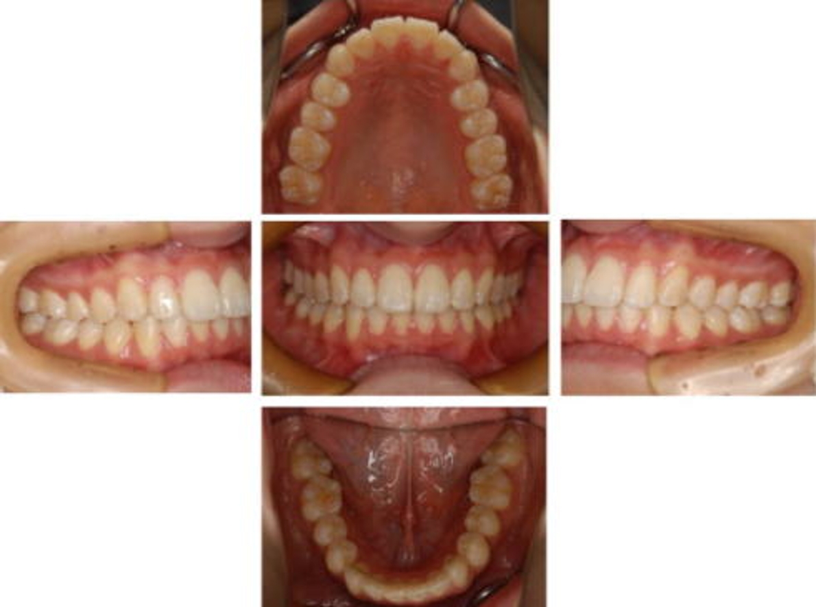 歯 の話 お知らせ たかまつファミリー歯科医院 病院 介護ナビ Milmil