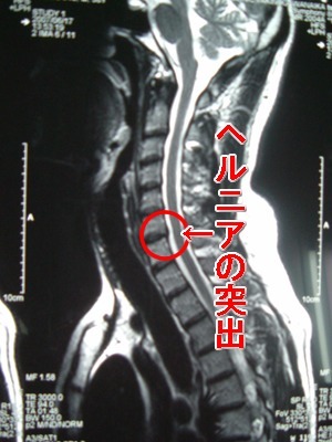 m01mri