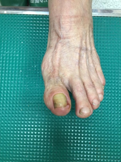 13501625_10013446299