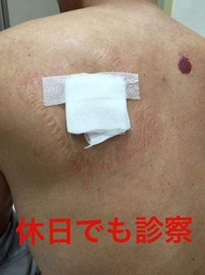 14432946_10706165863