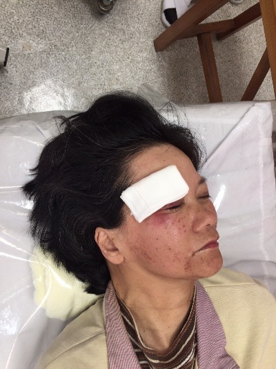 休日に頭を切ったときに受診して縫合 傷を縫う 治療できる整形外科病院といえば善通寺ふじた医院 お知らせ 交通事故治療 整形外科病院 ふじた医院 病院 介護ナビ Milmil