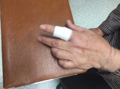 指の怪我、けが、切り傷