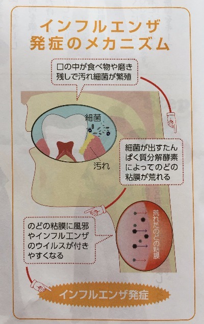 インフルエンザ発症メカニズム、初動負荷運