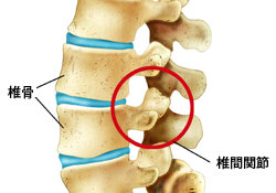 丸亀、善通寺、胸の痛み、椎間関節、椎骨、