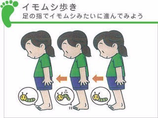 善通寺 丸亀 シンスプリント スネの痛み