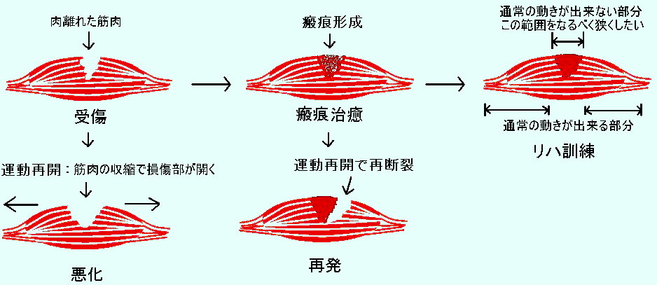 首 の 肉離れ