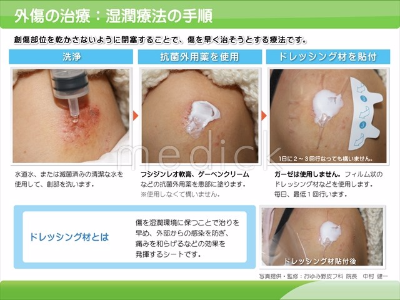 丸亀 善通寺 傷をきれいに直す病院 湿潤
