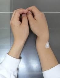 骨折、初動負荷運動トレーニングマシーン、